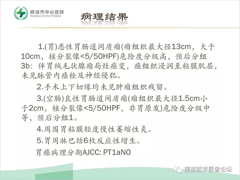 【病例】胃部胃肠道间质瘤1例X线CT影像