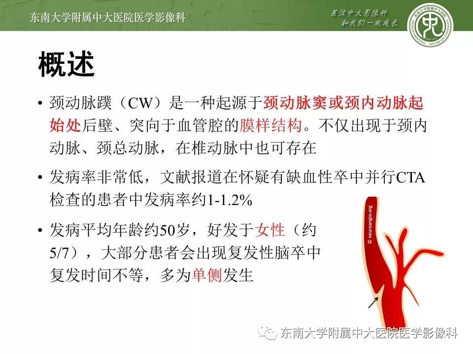 【PPT】颈动脉蹼