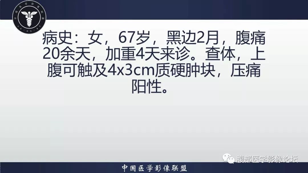 【病例】小肠间质瘤1例CT影像