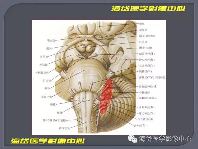 【PPT】基于MR增强扫描的桥小脑角区病变的影像学诊断