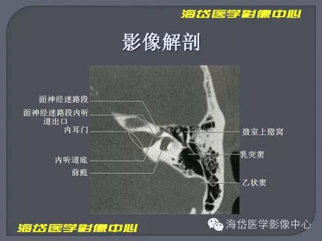 【PPT】基于MR增强扫描的桥小脑角区病变的影像学诊断