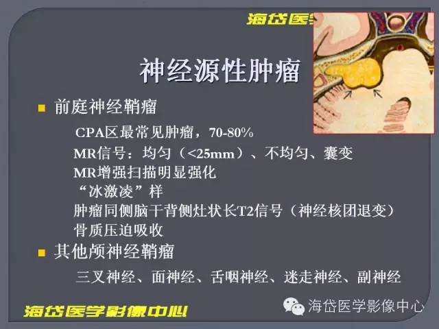 【PPT】基于MR增强扫描的桥小脑角区病变的影像学诊断