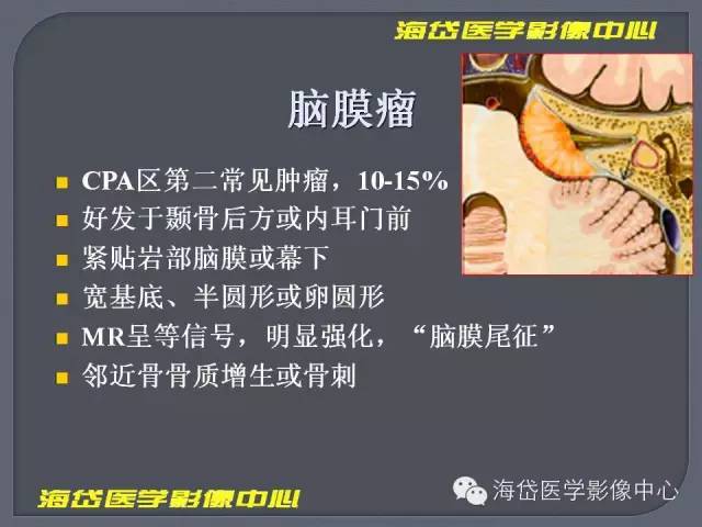 【PPT】基于MR增强扫描的桥小脑角区病变的影像学诊断