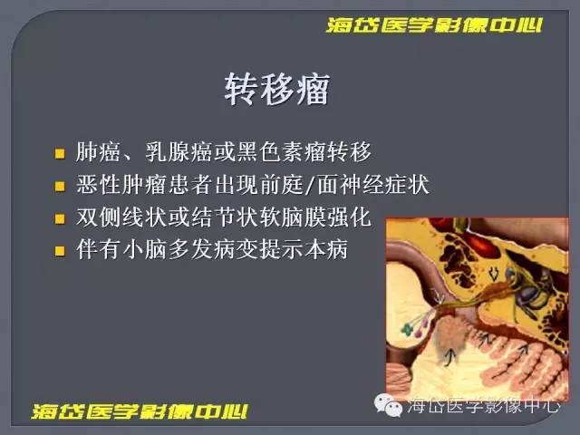 【PPT】基于MR增强扫描的桥小脑角区病变的影像学诊断