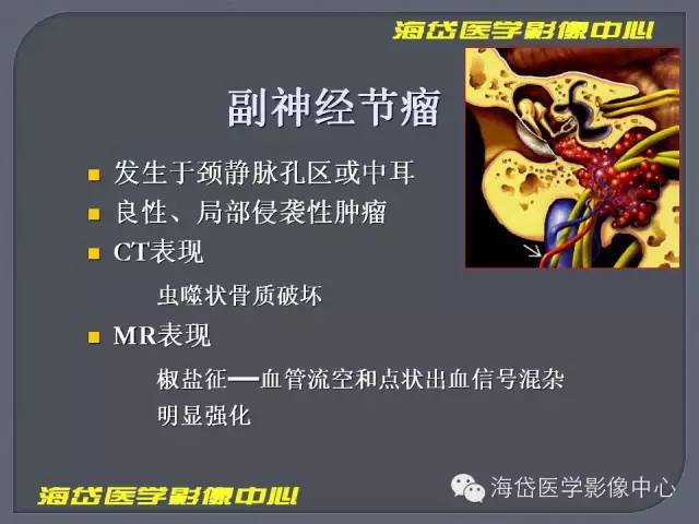 【PPT】基于MR增强扫描的桥小脑角区病变的影像学诊断