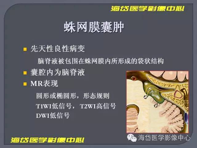 【PPT】基于MR增强扫描的桥小脑角区病变的影像学诊断