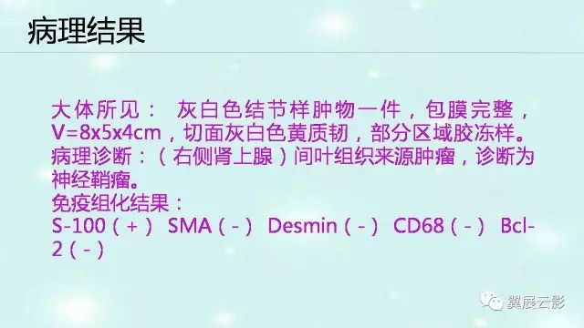 【病例】肾上腺神经鞘瘤1例CT影像