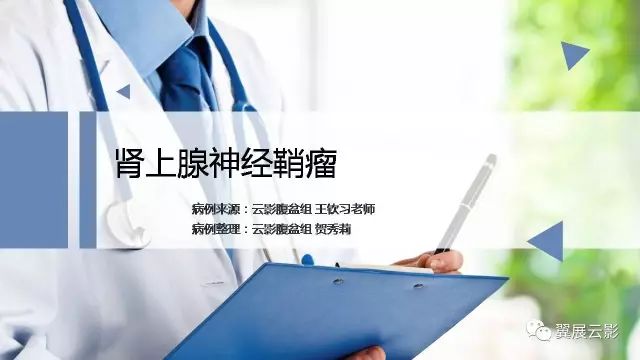 【病例】肾上腺神经鞘瘤1例CT影像