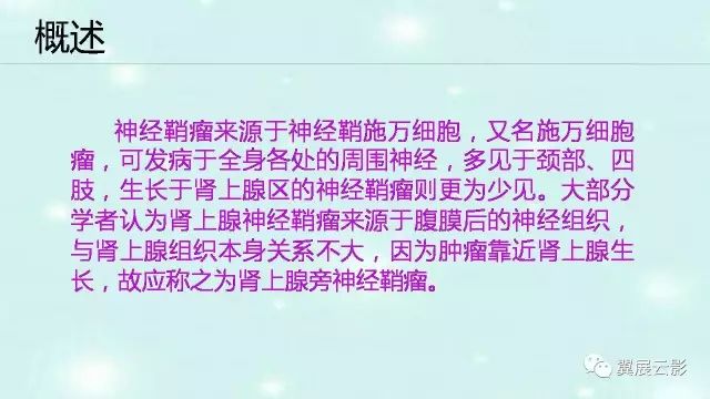 【病例】肾上腺神经鞘瘤1例CT影像