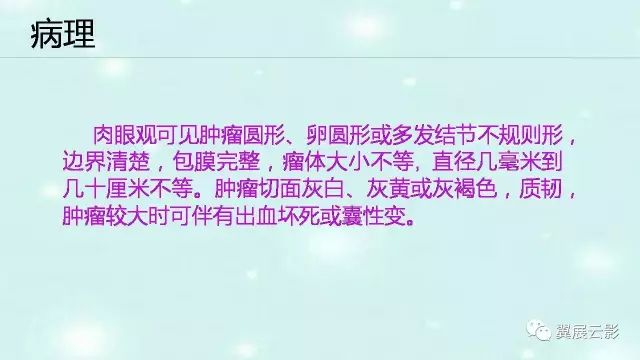 【病例】肾上腺神经鞘瘤1例CT影像