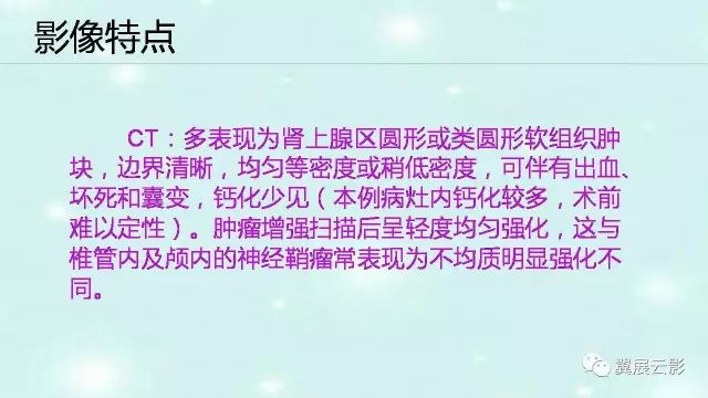 【病例】肾上腺神经鞘瘤1例CT影像