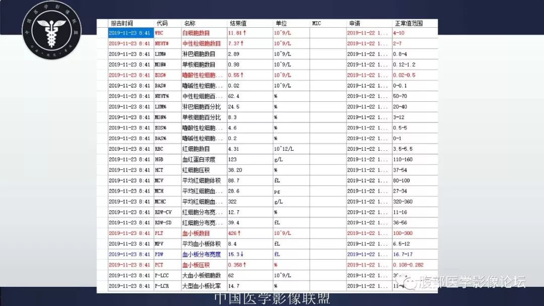 【病例】胆囊癌1例CT漏诊分析