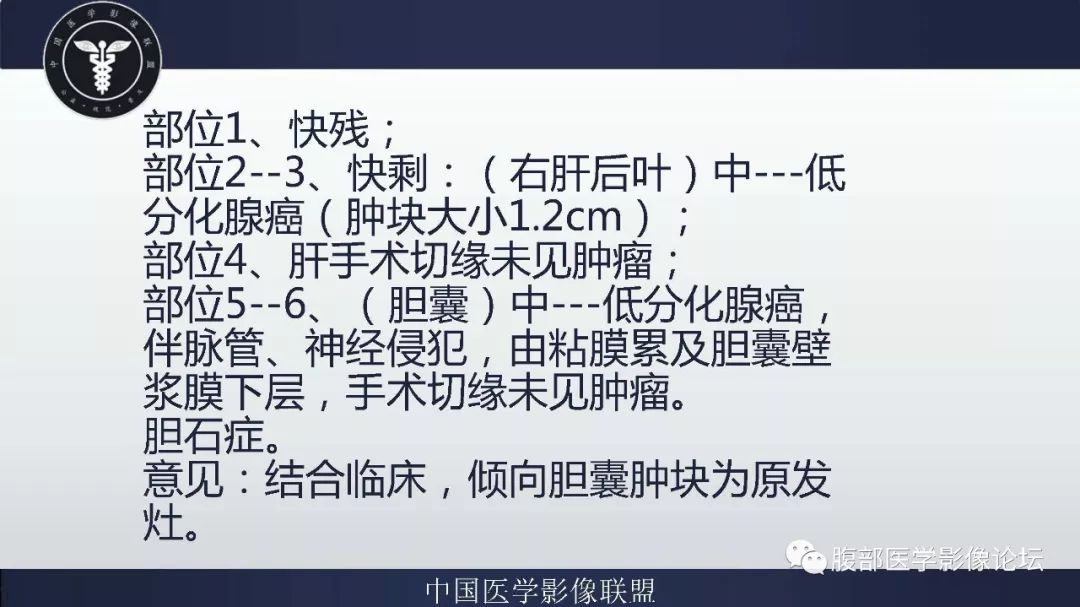 【病例】胆囊癌1例CT漏诊分析