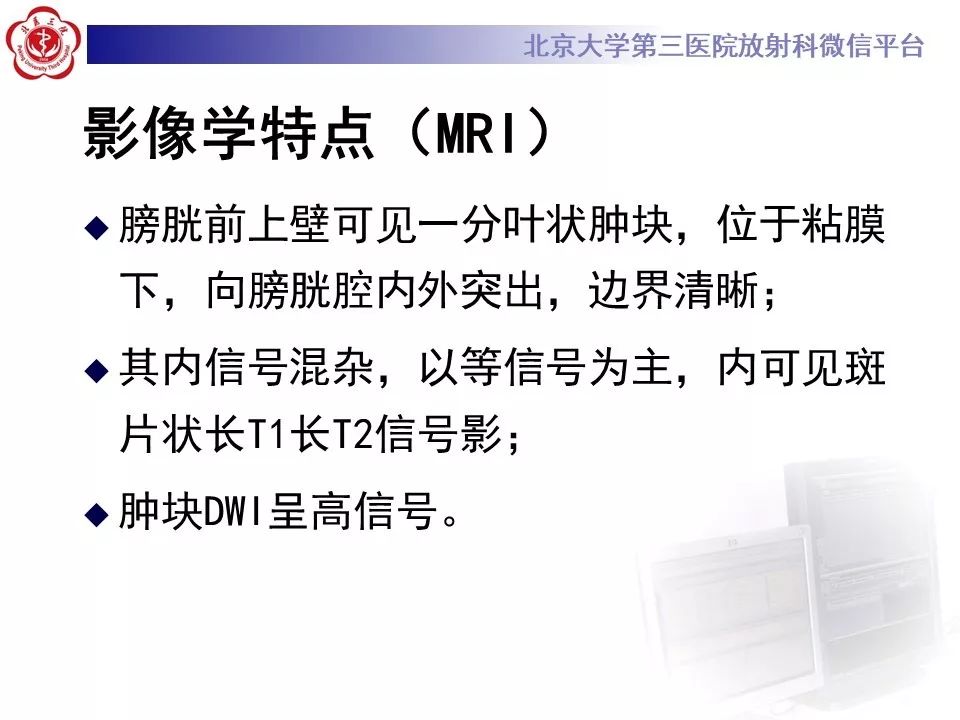 【PPT】膀胱平滑肌瘤