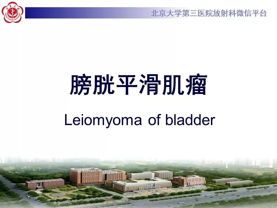 【PPT】膀胱平滑肌瘤