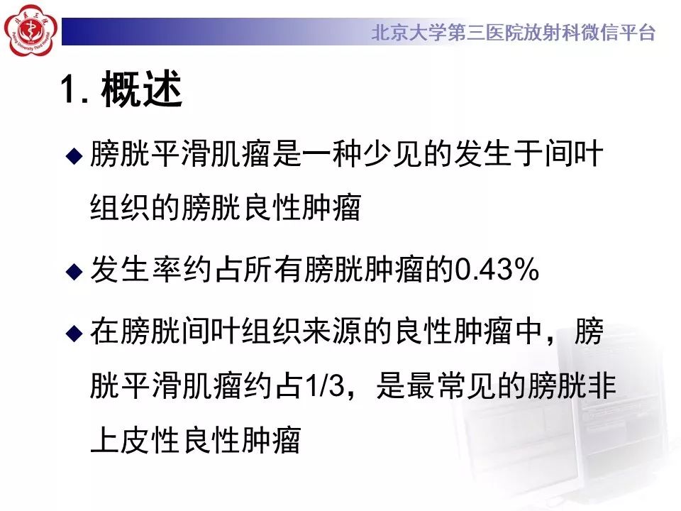 【PPT】膀胱平滑肌瘤