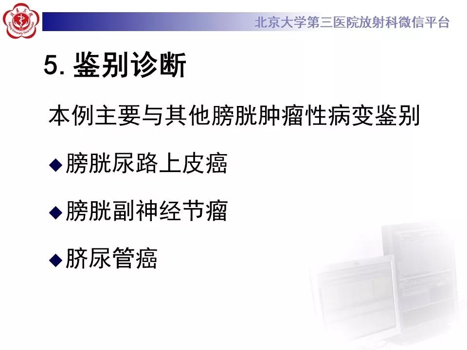 【PPT】膀胱平滑肌瘤