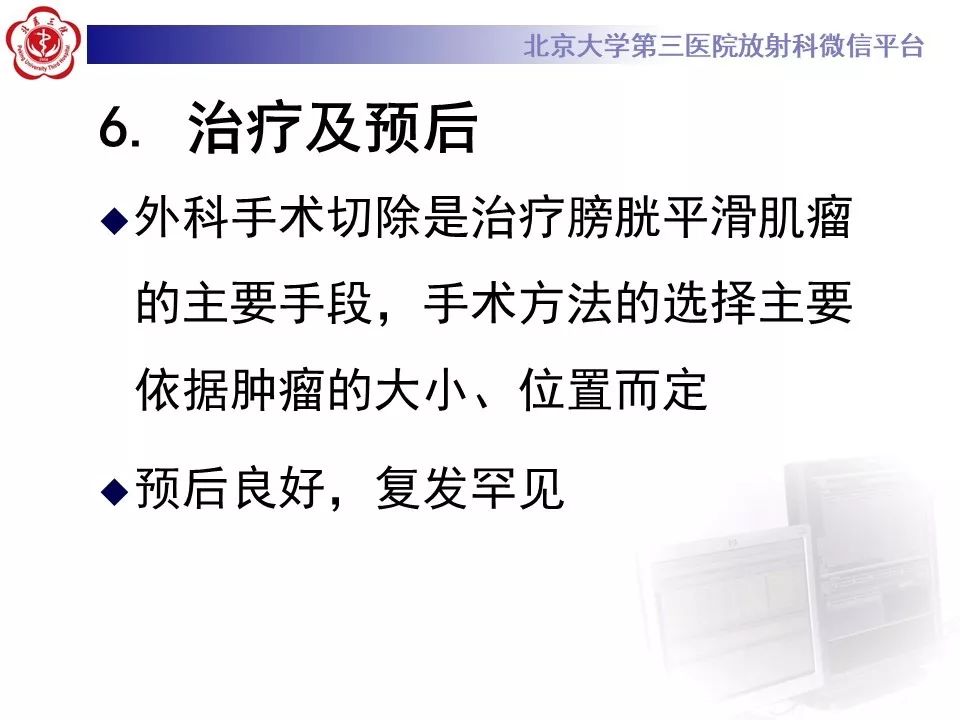 【PPT】膀胱平滑肌瘤