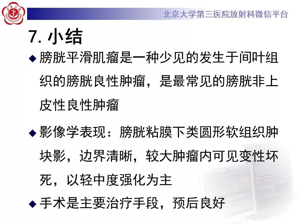 【PPT】膀胱平滑肌瘤