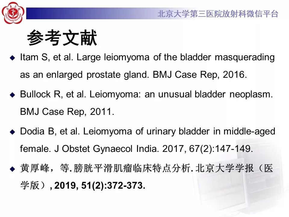 【PPT】膀胱平滑肌瘤