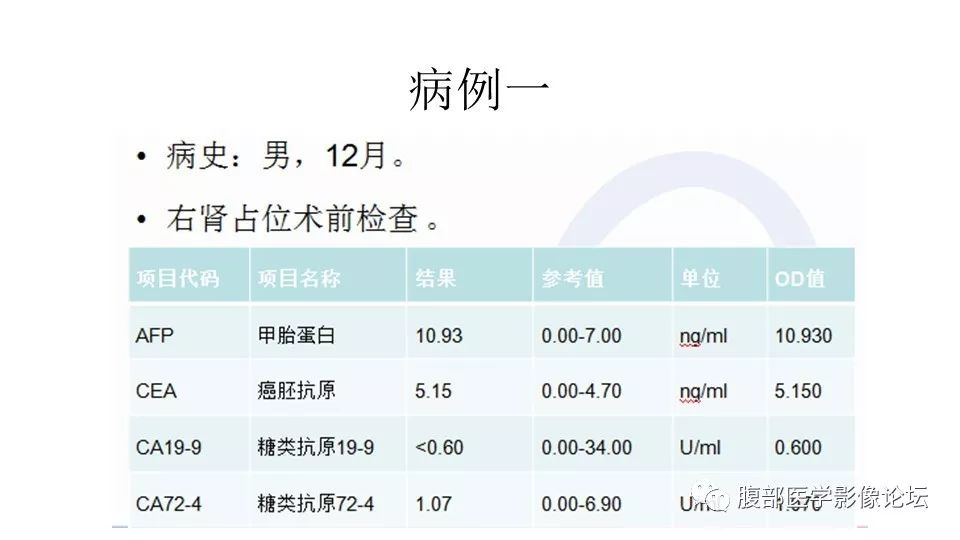 【病例】肾脏透明细胞肉瘤1例CT影像