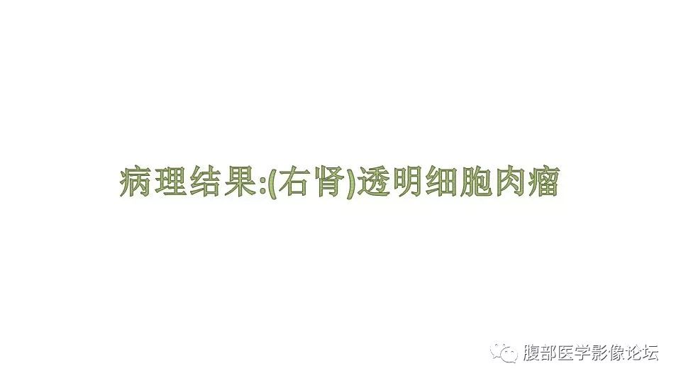 【病例】肾脏透明细胞肉瘤1例CT影像