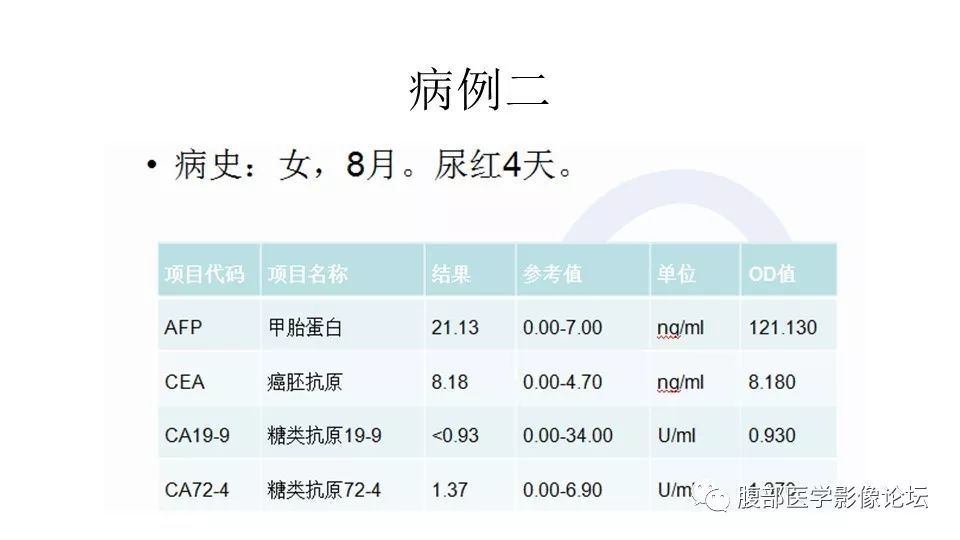 【病例】肾脏横纹肌样瘤1例CT影像