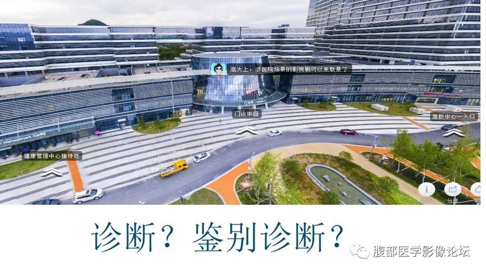 【病例】肾脏横纹肌样瘤1例CT影像