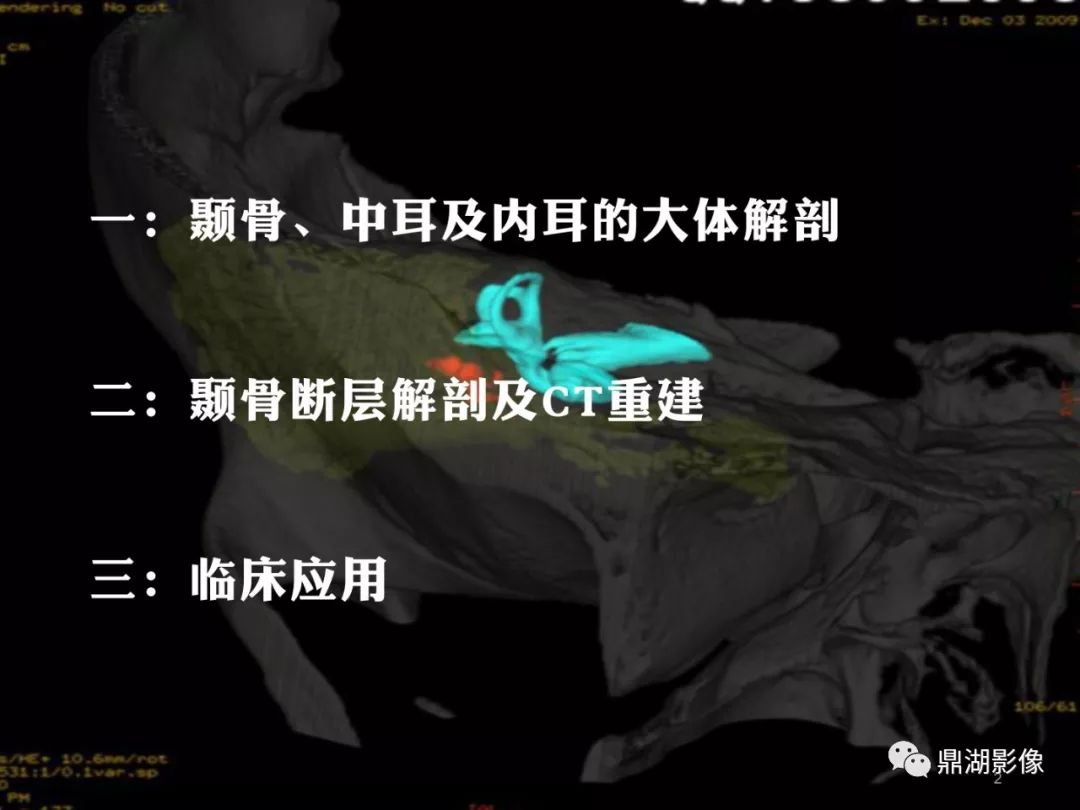 【PPT】颞骨断层解剖及CT三维重建