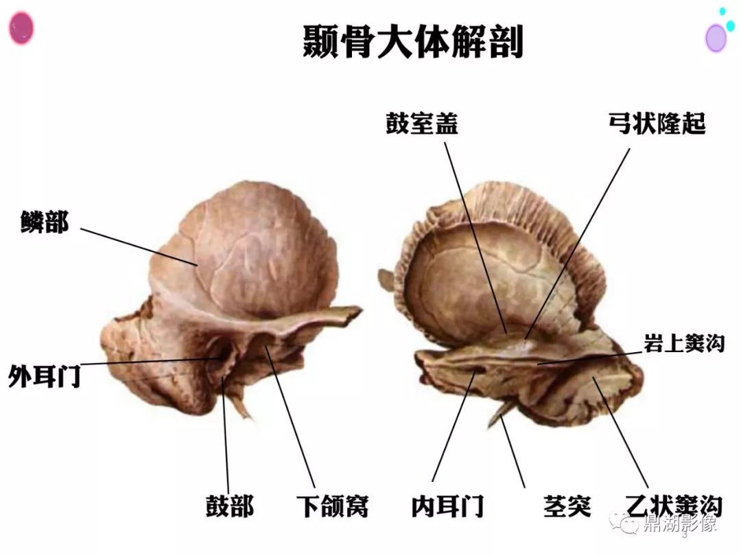 【PPT】颞骨断层解剖及CT三维重建