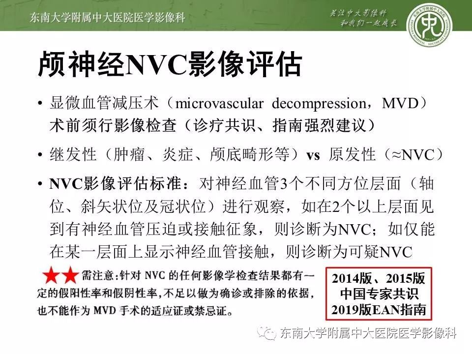 【PPT】颅神经血管压迫综合征