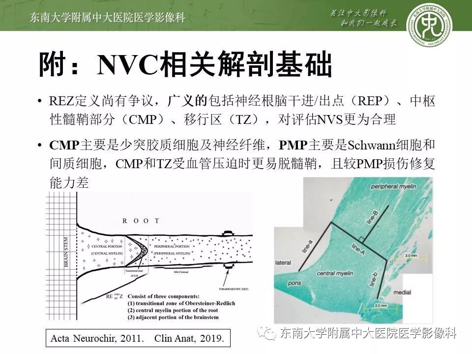 【PPT】颅神经血管压迫综合征