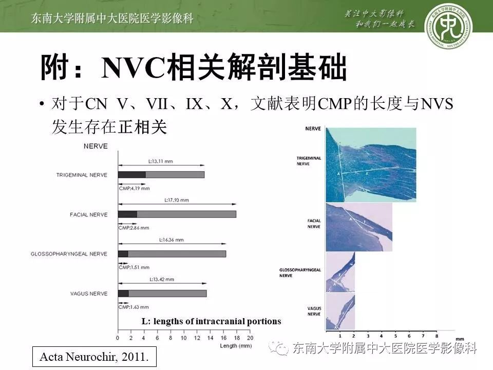 【PPT】颅神经血管压迫综合征