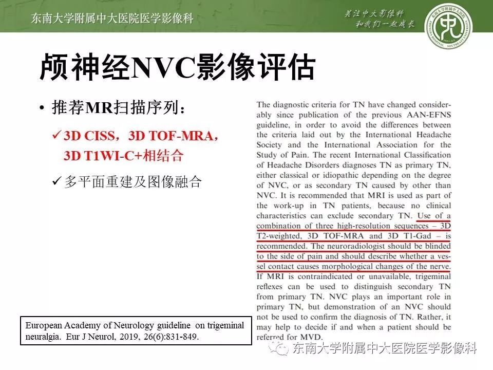 【PPT】颅神经血管压迫综合征