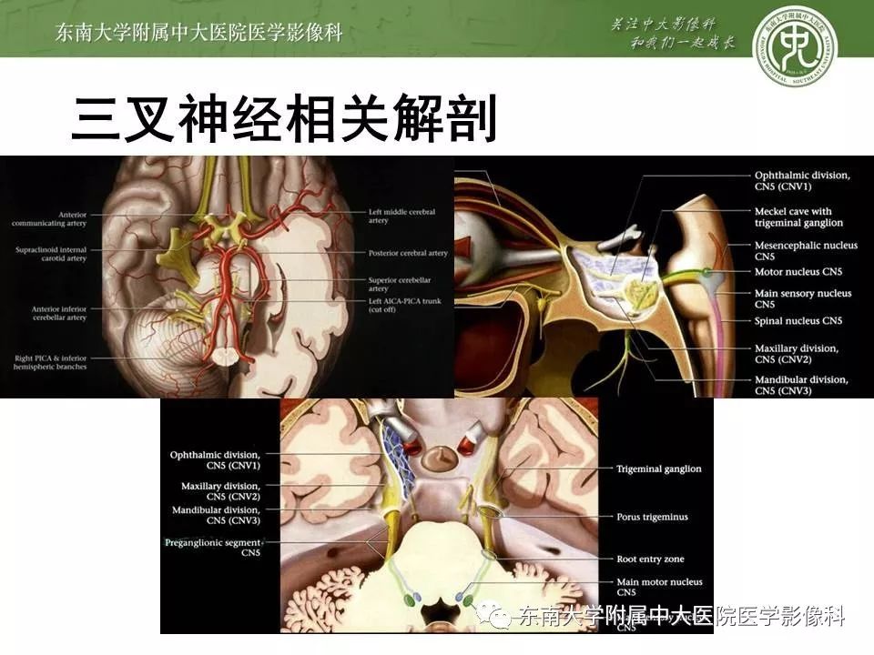 【PPT】颅神经血管压迫综合征