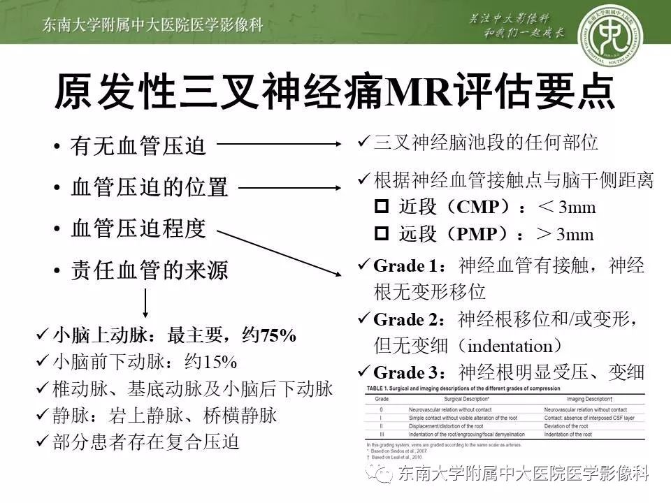【PPT】颅神经血管压迫综合征