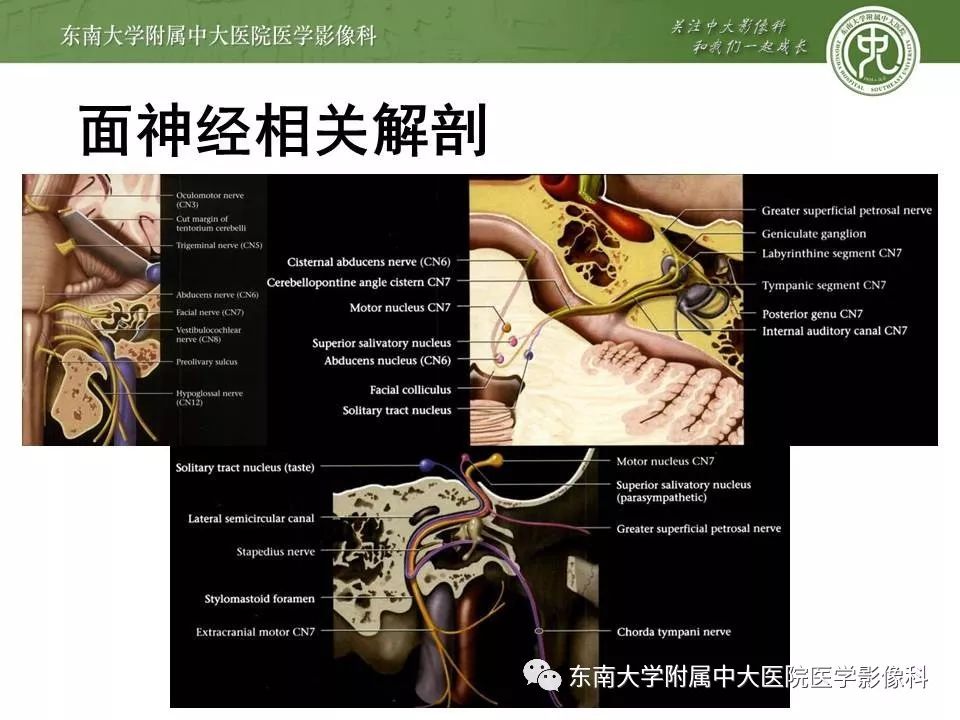 【PPT】颅神经血管压迫综合征