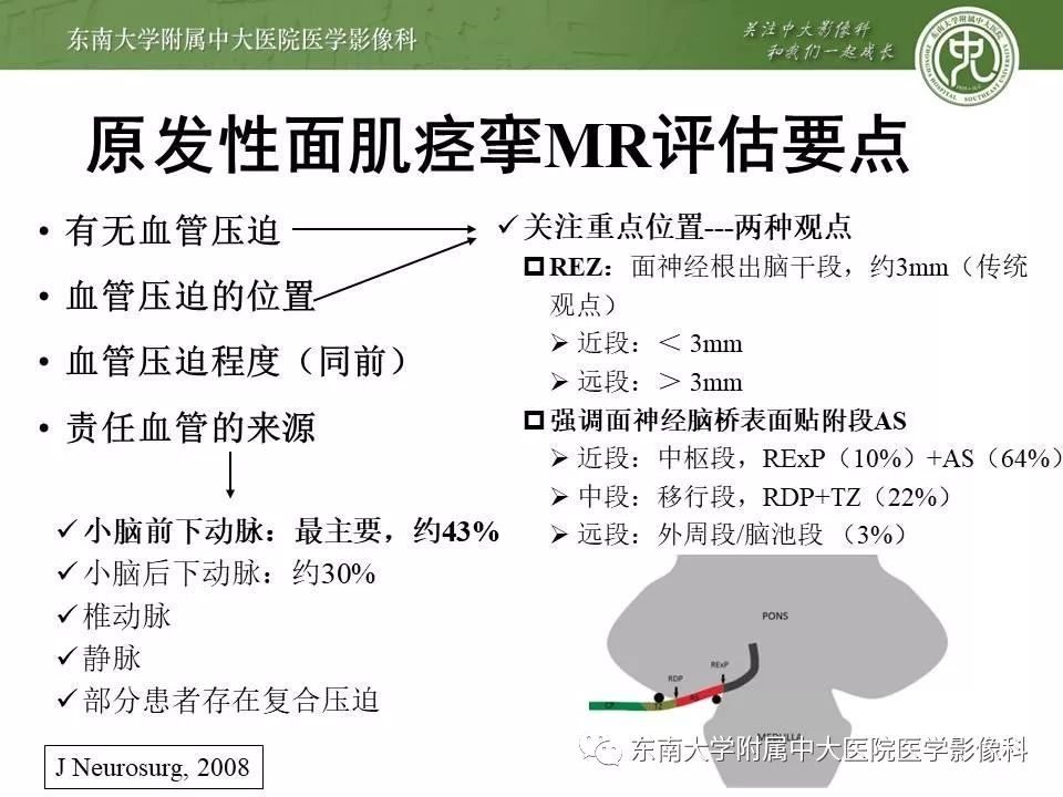 【PPT】颅神经血管压迫综合征