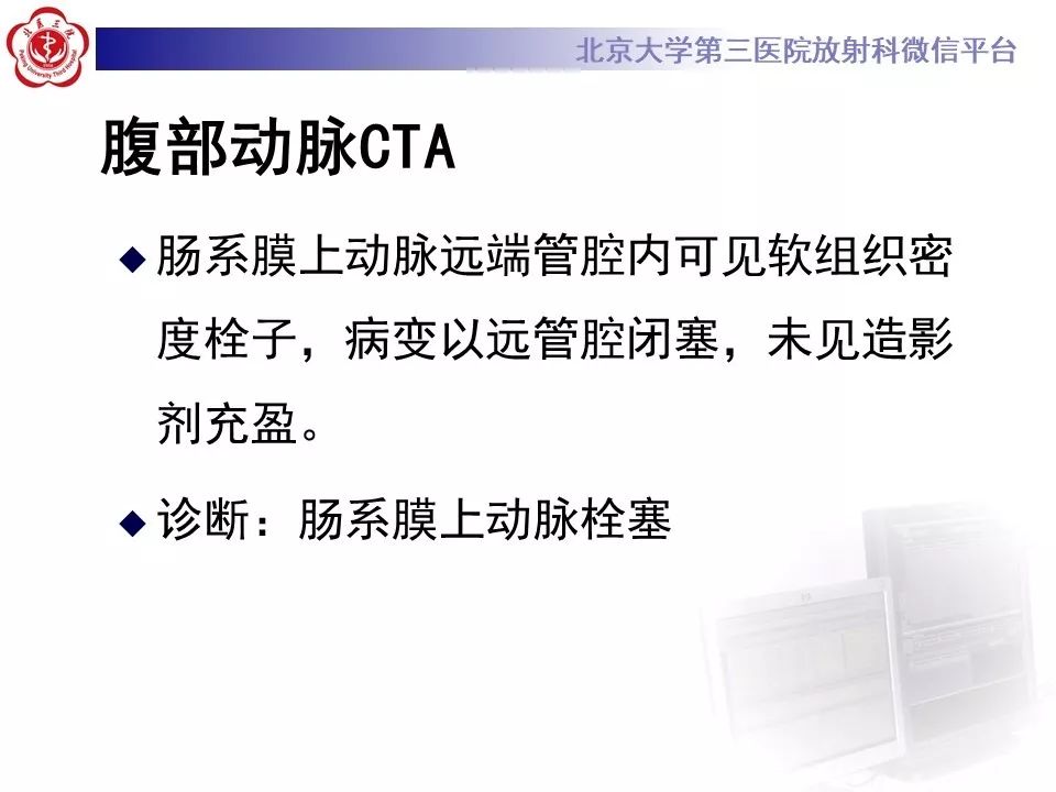 【PPT】肠系膜上动脉栓塞