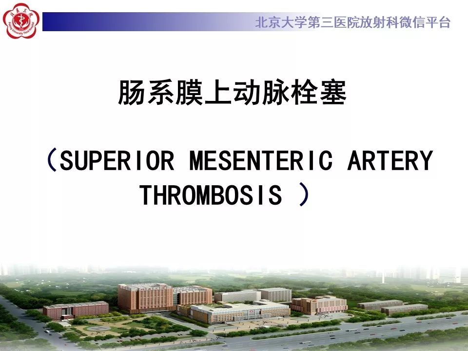 【PPT】肠系膜上动脉栓塞