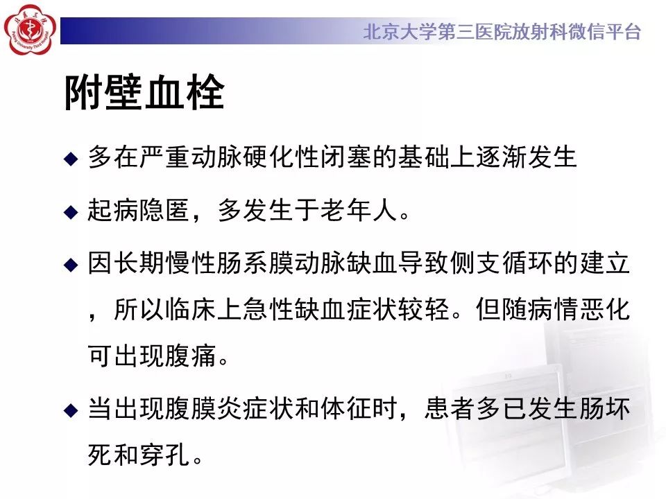 【PPT】肠系膜上动脉栓塞