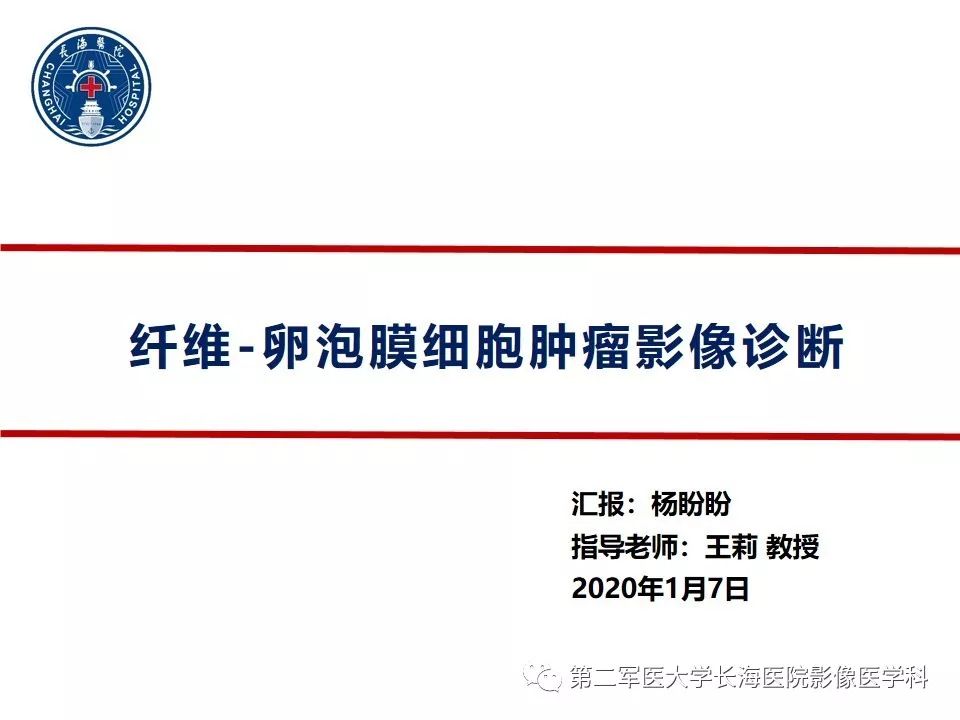 【PPT】纤维-卵泡膜细胞肿瘤影像诊断