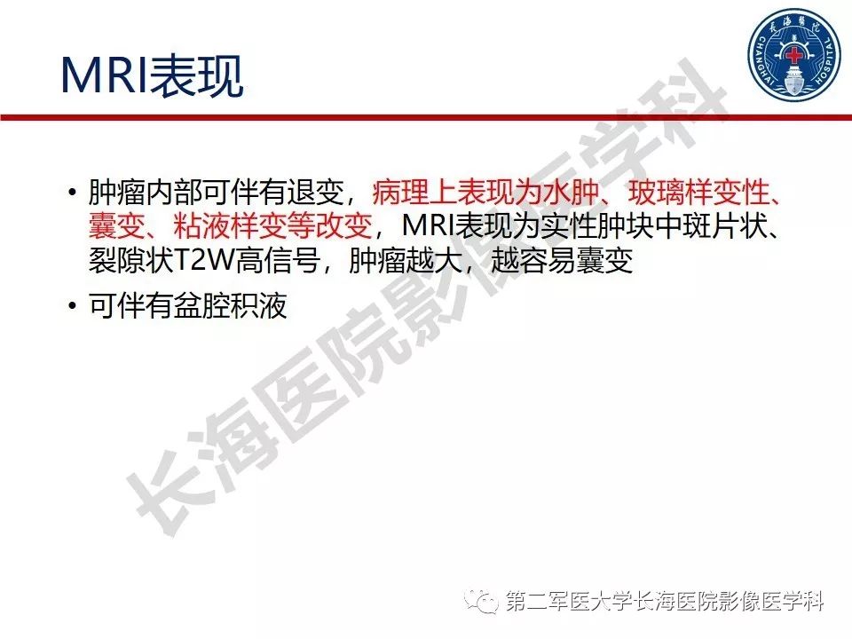 【PPT】纤维-卵泡膜细胞肿瘤影像诊断