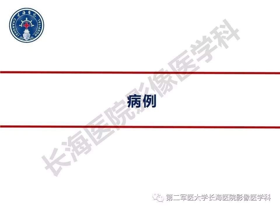 【PPT】纤维-卵泡膜细胞肿瘤影像诊断