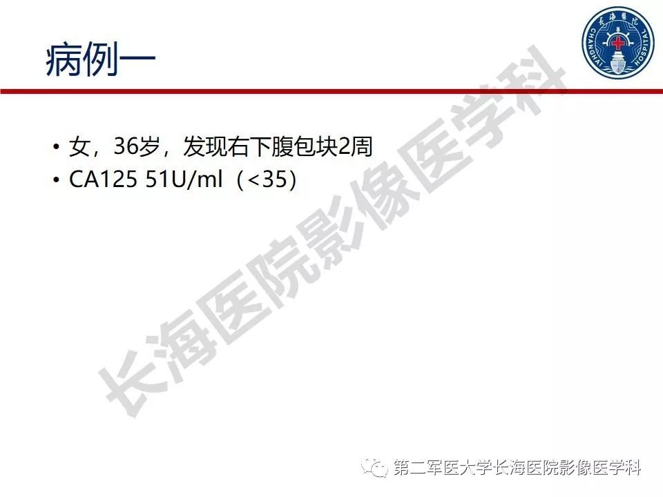 【PPT】纤维-卵泡膜细胞肿瘤影像诊断