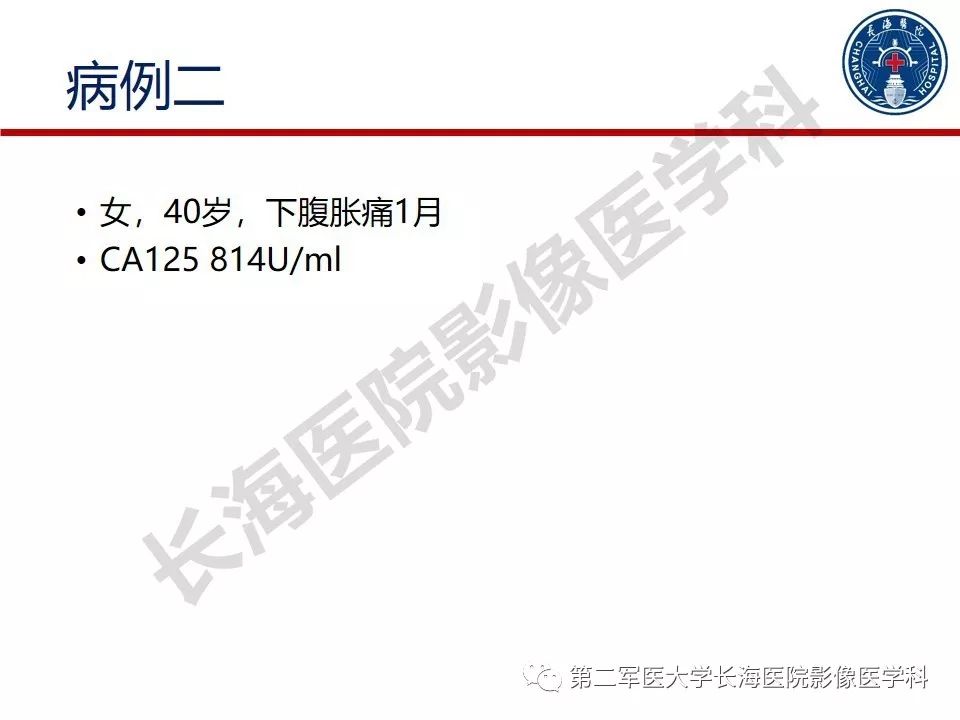 【PPT】纤维-卵泡膜细胞肿瘤影像诊断