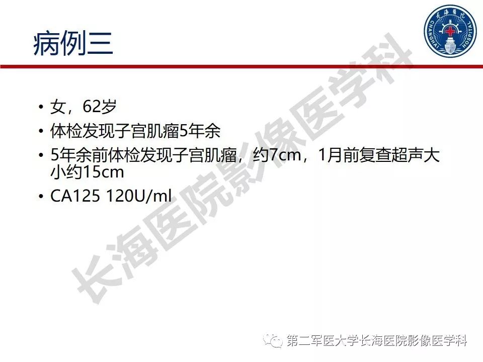 【PPT】纤维-卵泡膜细胞肿瘤影像诊断