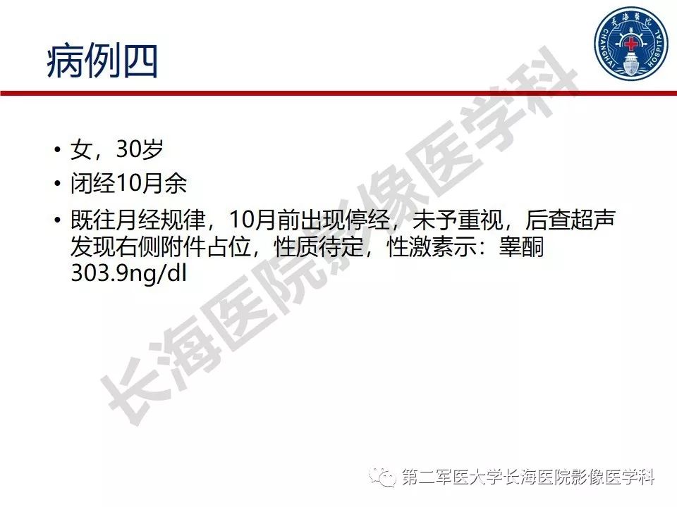 【PPT】纤维-卵泡膜细胞肿瘤影像诊断
