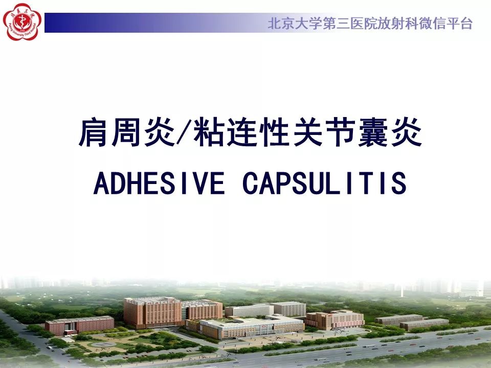 【PPT】肩周炎/粘连性关节囊炎影像表现