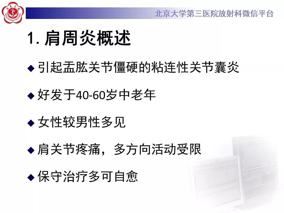 【PPT】肩周炎/粘连性关节囊炎影像表现
